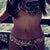 a few months post op may14 surgery this pic taken in August. 3 months post op and it only gets better...