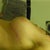 post op day 31, side. The scar is actually redder than it looks here. I'm trying shea butter at PNW's recommendation.