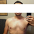 10 months post-op.