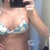 10 days post op in an old bathing suit that used to be too big!! Uneven dropping, and they are definitely taking their time,but we're getting there! Wish I would've gone a little bit bigger though....