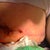 As you can see it randomly opens and bleeds rather quickly altho I do not take any blood thinners at all.