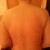 POD 7: look at all the lipo sites! Stuck to mid body but may need to lipo armpits.and no bruising!