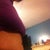 3 1/2 weeks post op