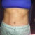 7.5 weeks post op 

Starting to get the definition i've always wanted in my stomach muscles!  6 pack here i come!