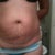 I should of submitted  this pic earlier ... This was taken out before my surgery.. Wanted to share it...