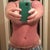 Tummy tuck 3/12