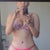 4 months post op