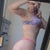 4 months post op