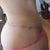 4 months post op