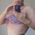 4 months post op