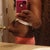 extra skin