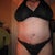 11 weeks post-op
