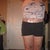 11 weeks post-op
