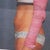 Scanned Picture Taken Before Procedure