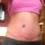 7wks PO