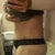 side view, swollen