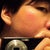 August 28, 2012 - A month after second procedure

Left side of my face reflected in a mirror