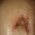 belly button