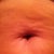 that used to be a cute little pierced belly button.  Now it is a collapsed mess with a scar coming out of it.
