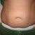 2 days before surgery