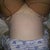 2 days PO laying in bed ( Can't flip this pic sorry)