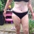 23 days post op - some swelling still