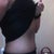 Before smart lipo