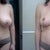 34G to 34D