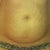 My belly, def need a TT, but really want a low bikini scar