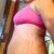 Swollen side view but better than before