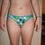 Before SmartLipo