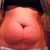 Pre-Op Photo 1
