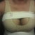 Well, hello ladies! 2 days post-op, with 560 CC's