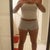 9 Days Post-Op W/Out Garment