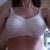 Post opp end of day 9. New bra that I just purchased after my first post opp appointment (one week after surgery).