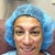 Going into surgery - goodbye nose!
