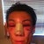 Me when I got up this morning, wow was my right eye swollen