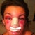 By the end of the 2nd day post op, this is what i looked like
