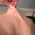 loose skin above belly button