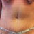 My new tummy 2 Days PO!