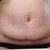 5-6 weeks