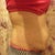 right side..3/28/12