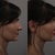 Before and after computer version