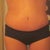4 weeks post op