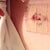 Have no idea what I did to cause this bleeding-bleeding it at the top of bellybutton.  Excuse dried blood inside bellybutton...not allowed to clean it yet :-/