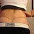 Scar 6 months post op