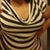 Me now 2 weeks post op