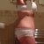 4 months post op prior to hernia surgery