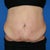 tummy front