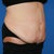tummy right side